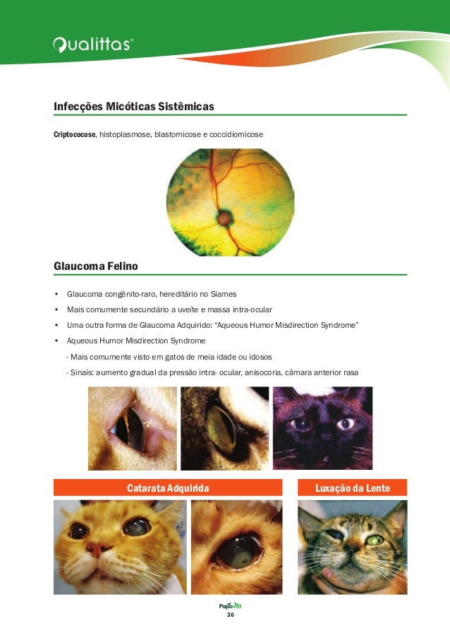 Catarata Congenita Ebook Download